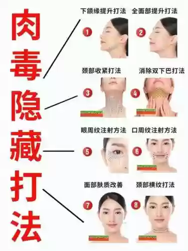 肉毒阵容插图