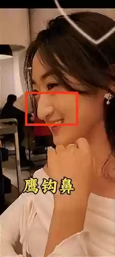 鹰钩鼻阵容插图1